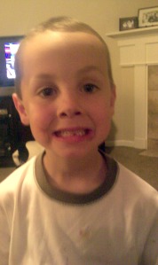 Owen's lost tooth